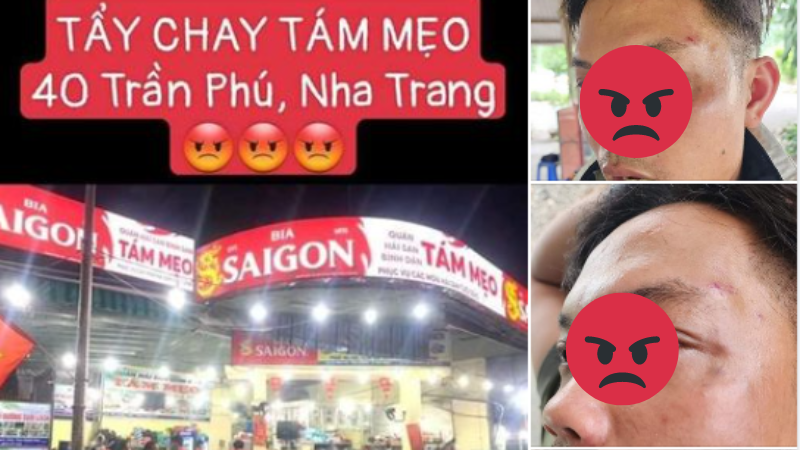 Chồng bị đánh ở Nha Trang, vợ phẫn nộ lên tiếng với cả nhà hàng trên mạng xã hội  - Ảnh 2